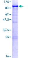Human SWAP70 Protein (Recombinant GST)