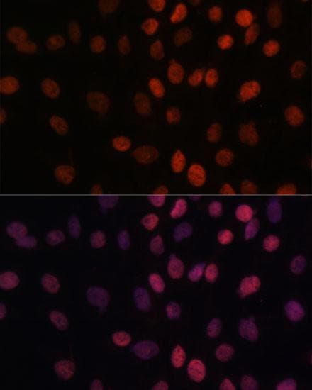 ARID1B / BAF250B Antibody