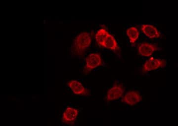 HEXB Antibody