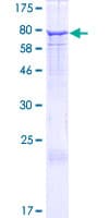 Human EHD2 Protein (Recombinant GST)