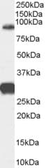 IHC-plus™ Polyclonal Goat anti-Human FOXP2 Antibody (aa484-497, IHC, WB)