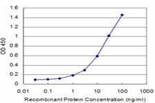 AKT2 Antibody (clone X1)
