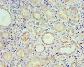 STC1 / Stanniocalcin Antibody (aa18-247)