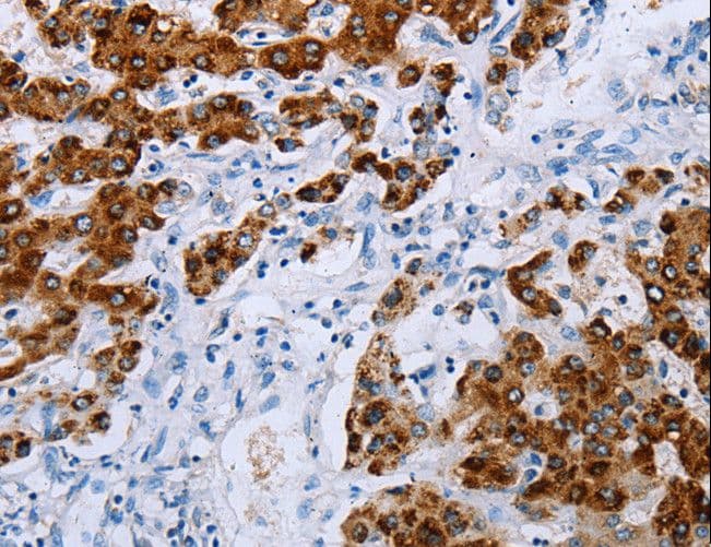NDUFA12 / B17.2 Antibody