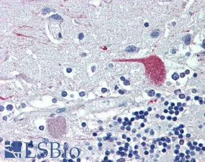 IHC-plus™ PSIP1 / LEDGF Antibody