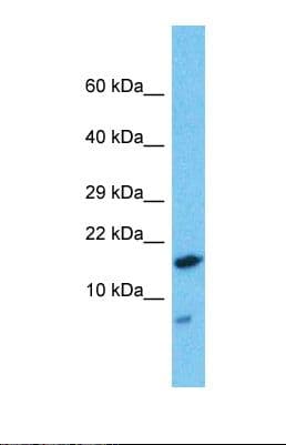 Polyclonal Rabbit anti-Human HDDC2 Antibody (N-Terminus, WB)