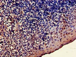 Polyclonal Rabbit anti-Human TRADD Antibody (IHC, IF, WB)