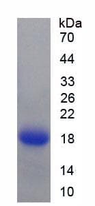 Human NPNT / Nephronectin Protein (Recombinant His)