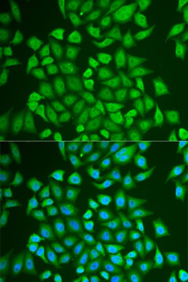 IHC-plus™ Polyclonal Rabbit anti-Human PIP / GCDFP-15 Antibody (IHC, IF)