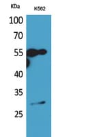CD20 Antibody