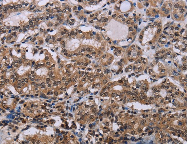 BP1 / DLX4 Antibody
