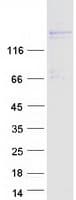 Human PRDM16 Protein (Recombinant Myc-DDK (Flag))