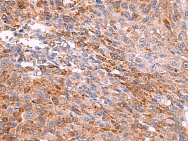 PEMT Antibody