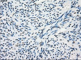 Monoclonal Mouse anti-Human FRK Antibody (clone OTI6D2, IHC, IF, WB)
