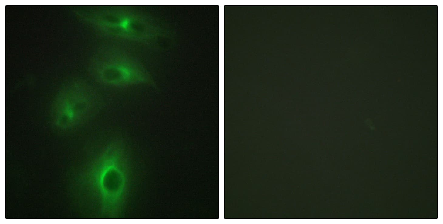 IHC-plus™ Polyclonal Rabbit anti-Human TMPRSS3 Antibody (aa405-454, IHC, IF, WB)