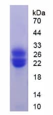 Rat CSF3R / CD114 Protein (Recombinant His)