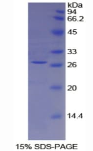 Mouse TFPI2 Protein (Recombinant 6His, N-terminus)