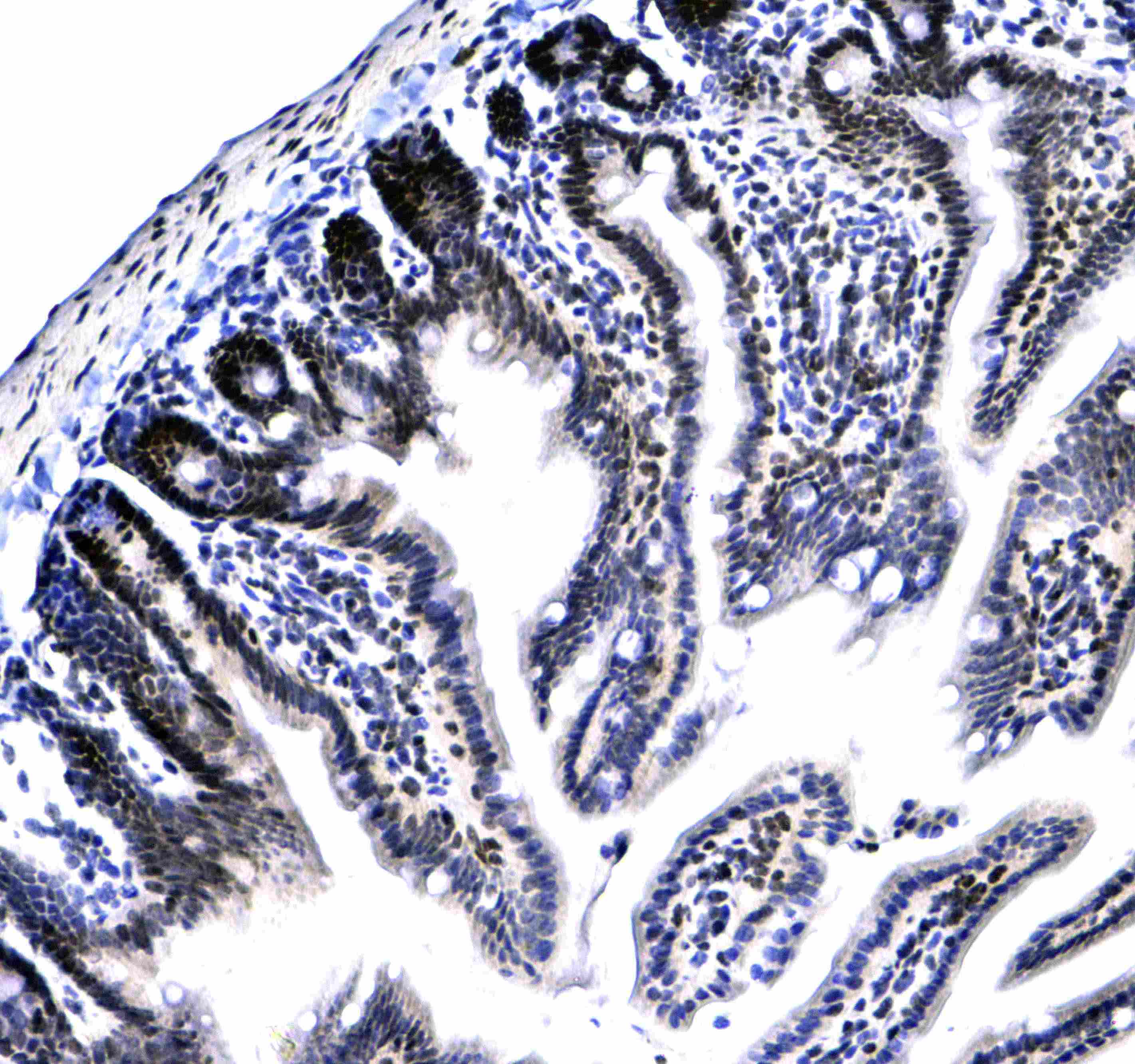 CBX3 / HP1 Gamma Antibody