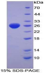 Mouse TRXR1 / TXNRD1 Protein (Recombinant His-T7)