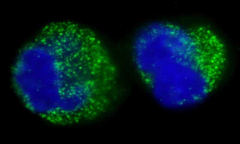 CML / BCR Antibody (aa50-100)
