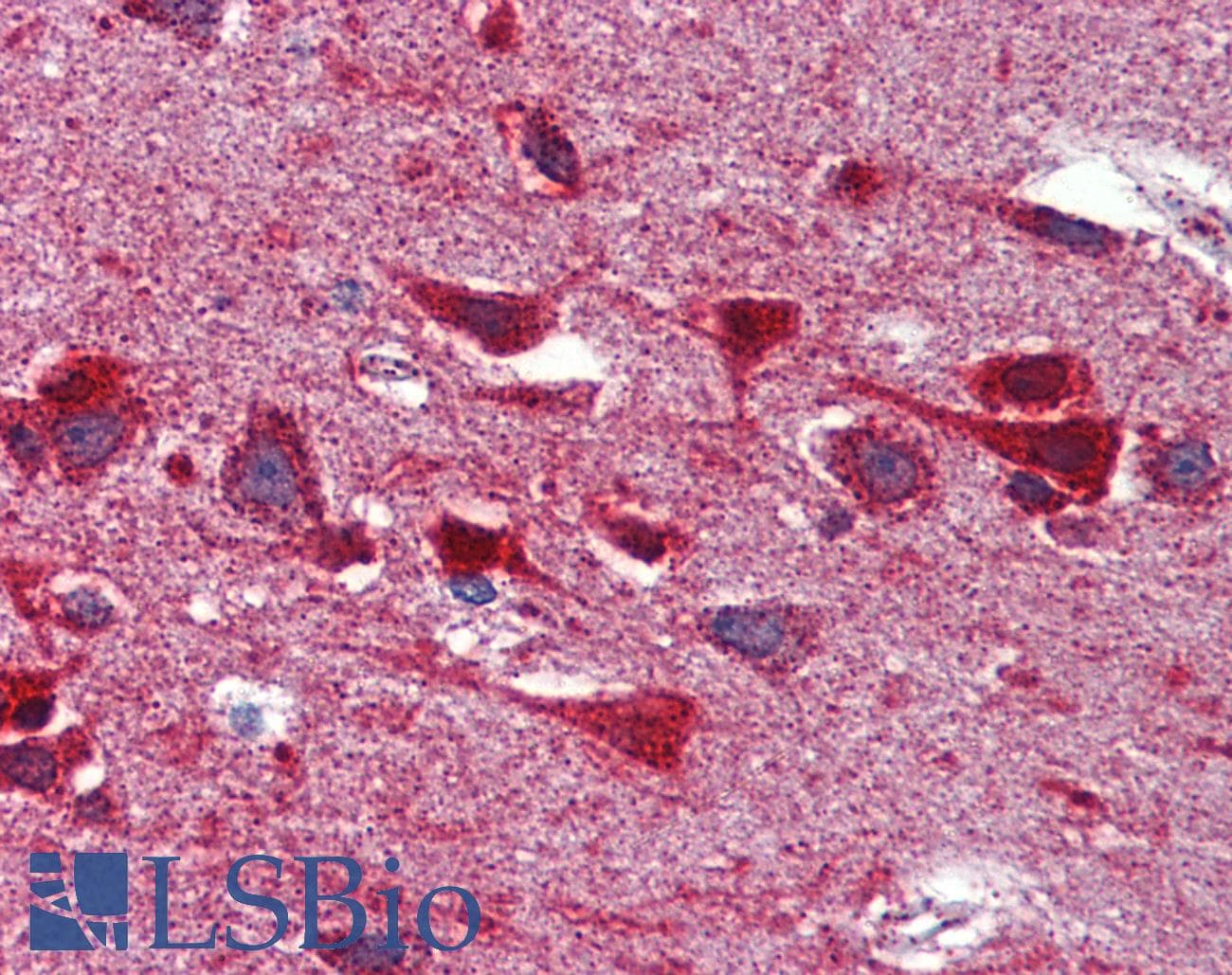 IHC-plus™ GOT2 Antibody (clone 3E9)