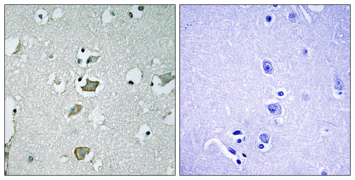 KCNJ2 / Kir2.1 Antibody (aa81-130)