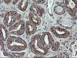 Monoclonal Mouse anti-Human VBP1 Antibody (clone OTI2C2, IHC, WB)
