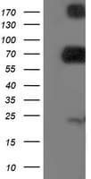 Dipeptidyl Peptidase 3 / DPP3 Antibody (clone OTI1E7)