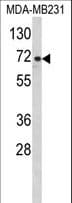 ARHGAP18 Antibody (aa180-207)