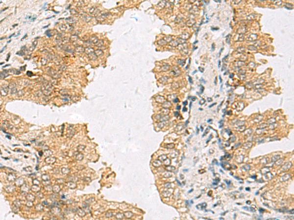 SLC30A6 Antibody