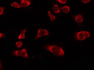 OR5H6 Antibody