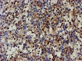 NQO2 Antibody (clone OTI1G2)