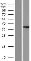 OLAH Protein (Over-Expression Lysate Myc-DDK (Flag))