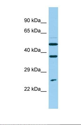 NUDT14 Antibody (N-Terminus)