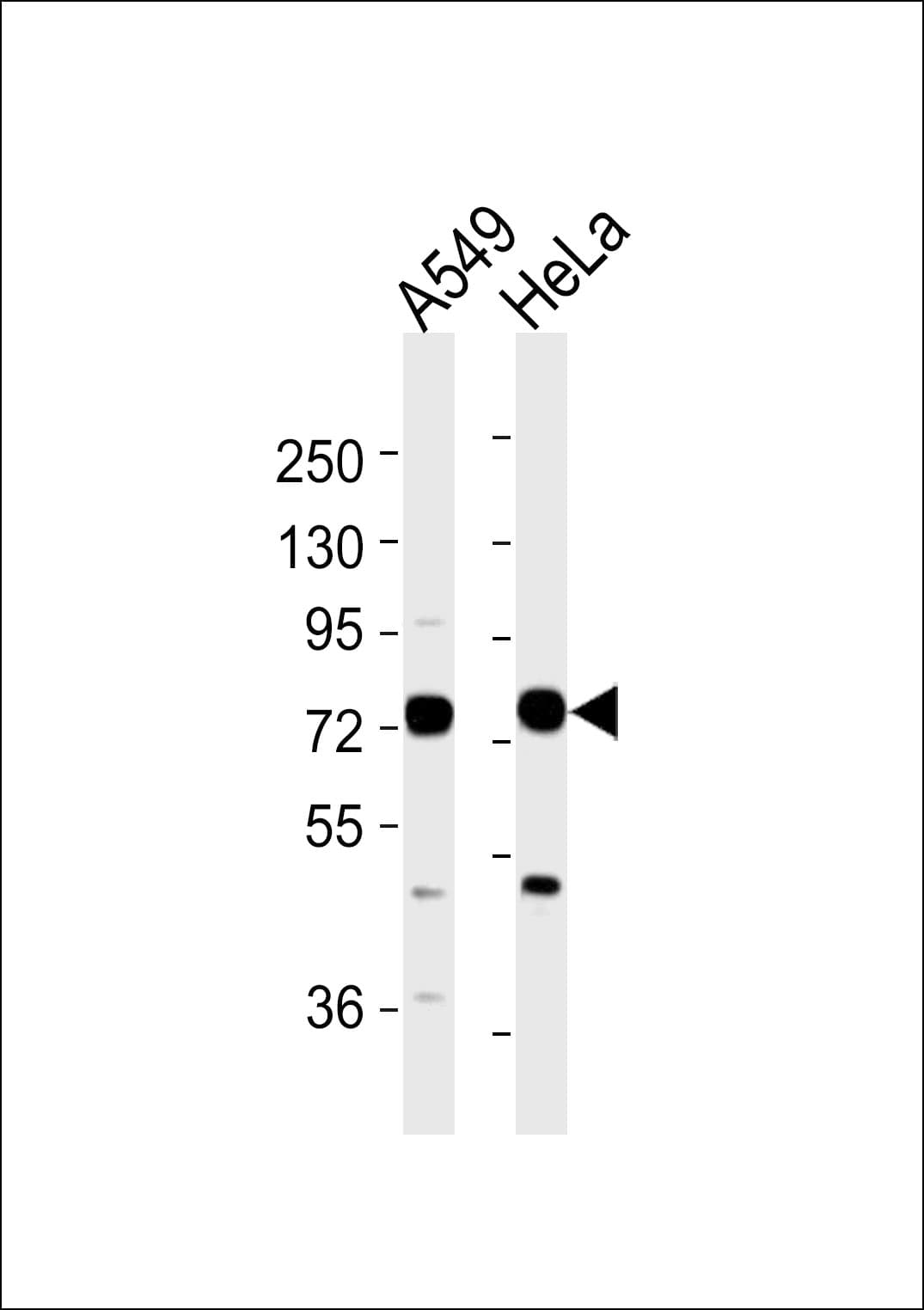 Polyclonal Rabbit anti-Human HKR1 Antibody (WB)