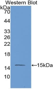MASP2 / MASP-2 Antibody (aa170-287)