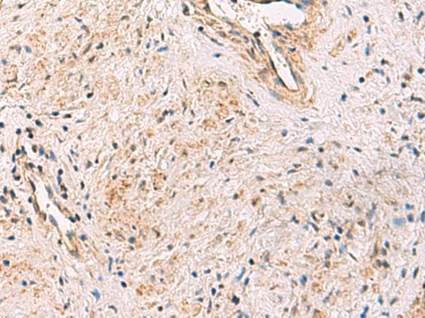 PCYT2 / ET Antibody