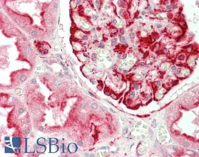IHC-plus™ ATP6E / ATP6V1E1 Antibody (clone 4E11)