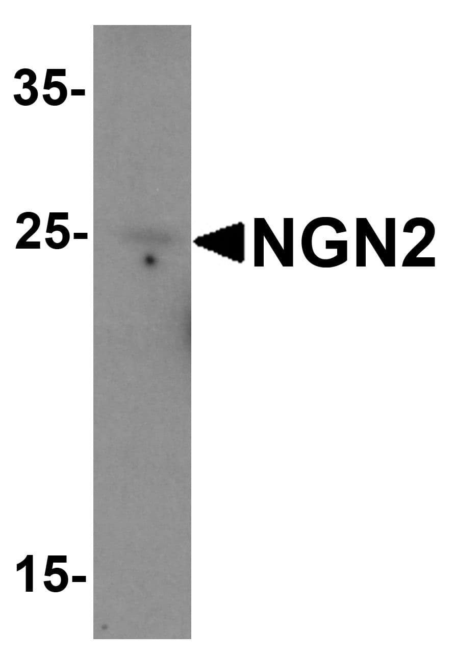 IHC-plus™ Polyclonal Rabbit anti-Human NEUROG2 / NGN2 / Neurogenin 2 Antibody (IHC, IF, WB)