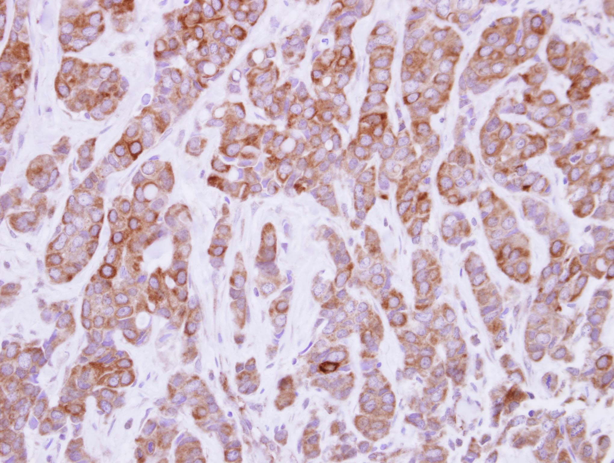 CAST / Calpastatin Antibody