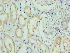 Polyclonal Rabbit anti-Human SLC39A6 / LIV-1 Antibody (aa170-320, IHC, WB)