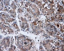 LIPG / Endothelial Lipase Antibody (clone OTI7D1)