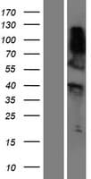Human RNF165 Protein (Over-Expression Lysate Myc-DDK (Flag))