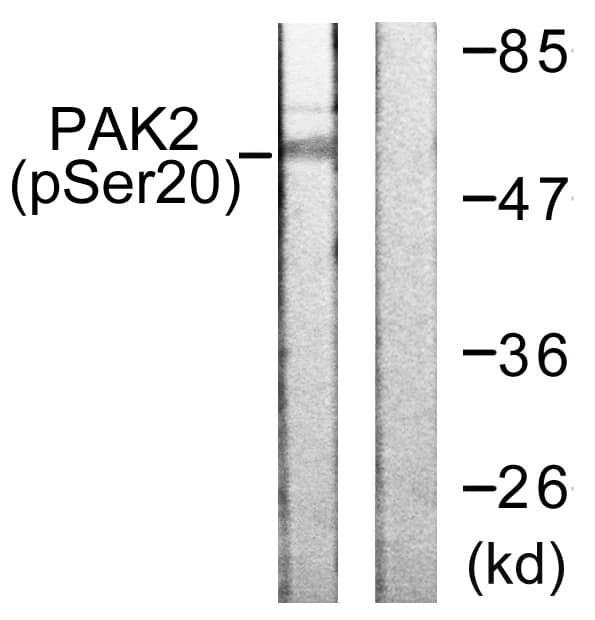 PAK2 Antibody (phospho-Ser20)