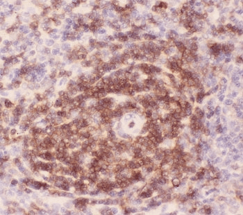 SPN / CD43 Antibody