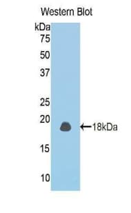 THBD / CD141 / Thrombomodulin Antibody (aa31-167, APC)