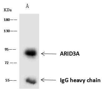 ARID3A / DRIL1 Antibody