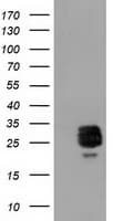 CLPP Antibody (clone OTI1G9)