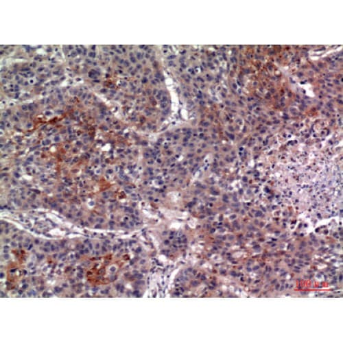 IL13RA2 / IL13R Alpha 2 Antibody (241-290 aa, Internal)