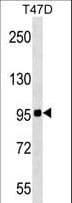 ZNF606 Antibody (aa215-243)